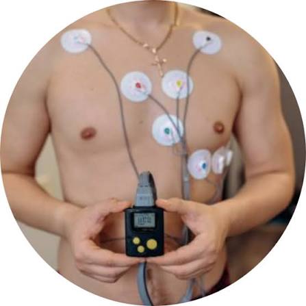 Illustration de l'examen Holter rythmique ( HOLTER  ECG )